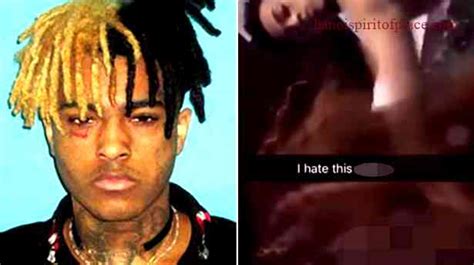 xxx tentacion autopsy pic|Autopsyfiles.org 